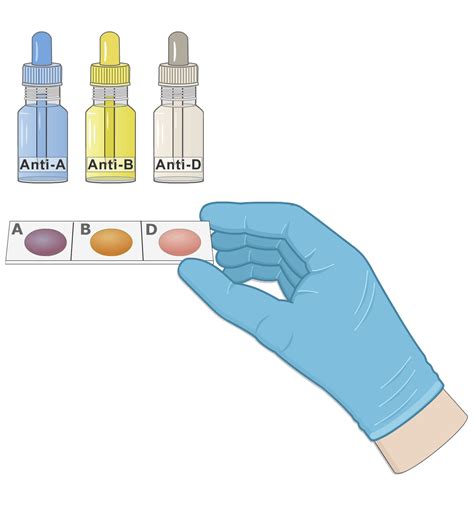 materials needed for blood typing